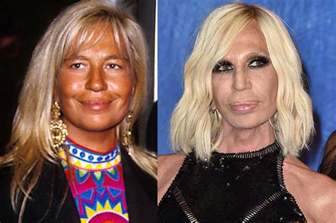 chirurgia donatella versace oggi|Biografia della stilista Donatella Versace, dalla morte di Gianni .